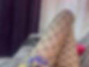 legs🥰🦶🏻