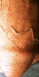 The World's Only Penis