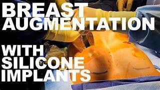 breast augmentation