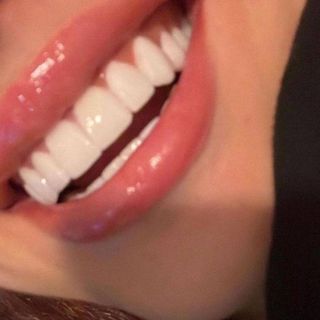 I'm saving up for a dentist!!!