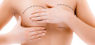 I operate my breasts