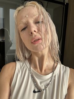 I really want to get veneers