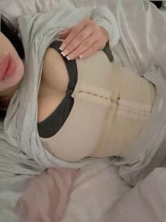 Do I want breast surgery?