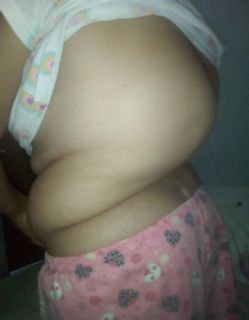 Operación de mi hija