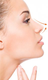 Риносептопластика